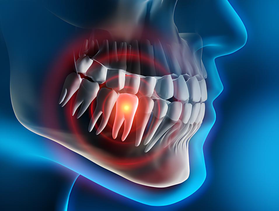 Teeth image - Emergency dentist Epping